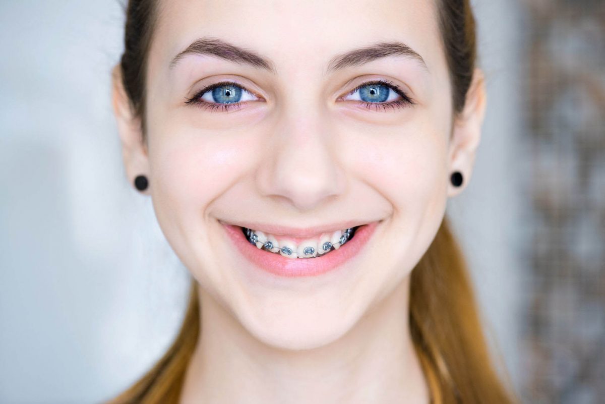 All About Braces Smile Suffolk Braces Suffolk, VA Orthodontist